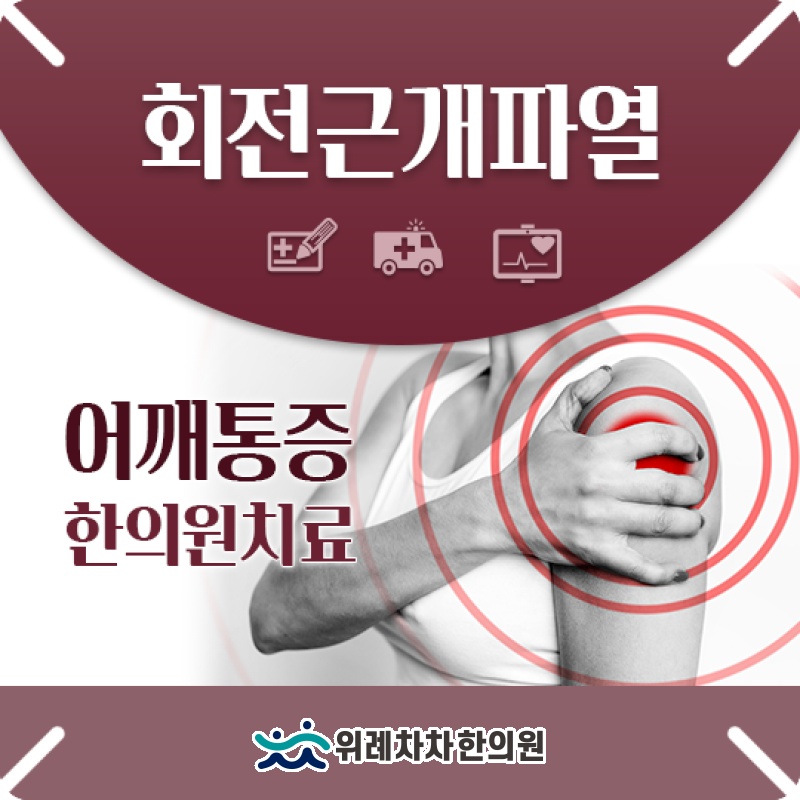 회전근개파열의 주요 증상과 양상별 특징