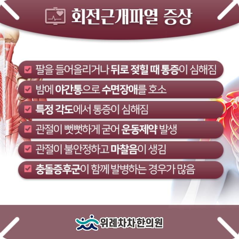 회전근개파열의 주요 증상과 양상별 특징
