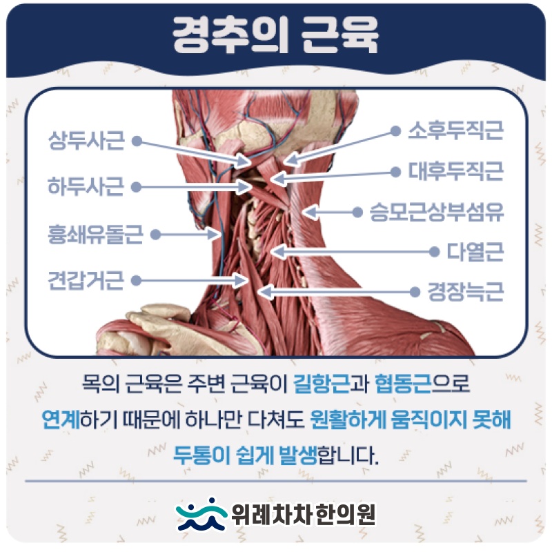 목 정렬 변화와 경추성두통이 나타나는 과정
