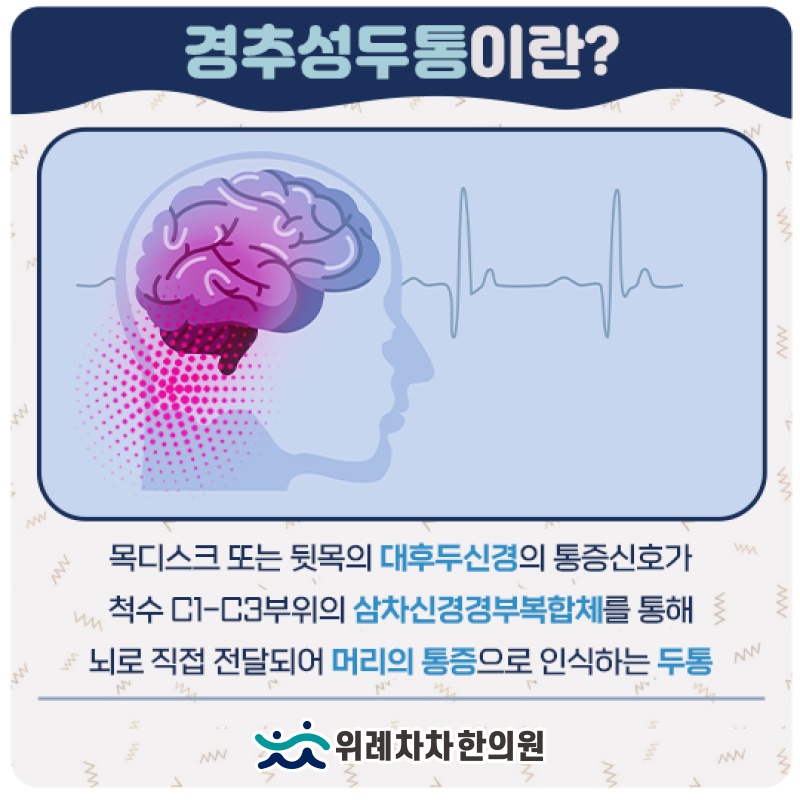목 정렬 변화와 경추성두통이 나타나는 과정