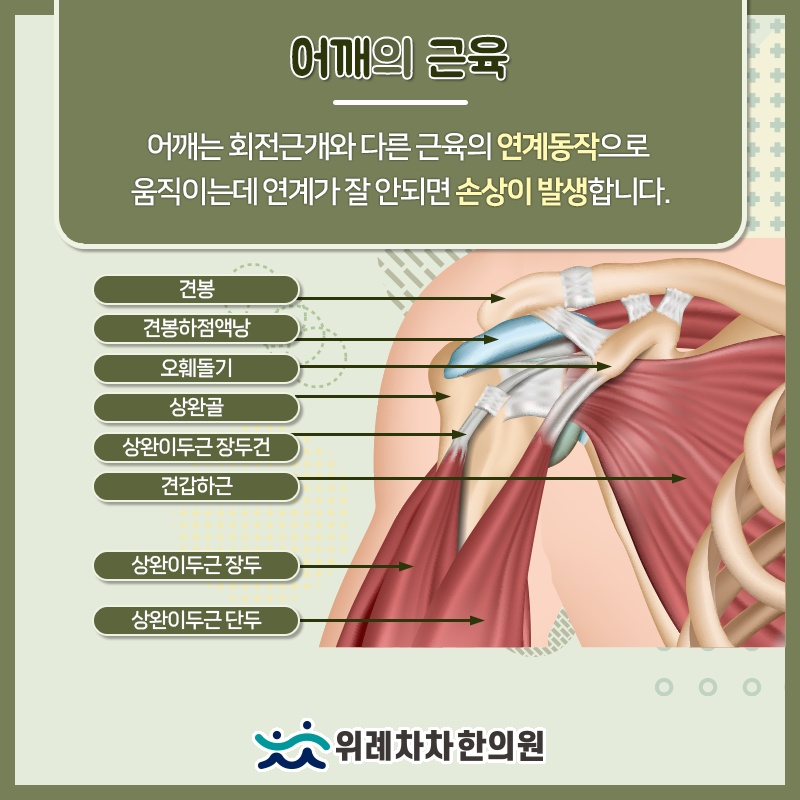 어깨뼈와 팔뼈의 마찰로 생기는 충돌증후군 이해하기