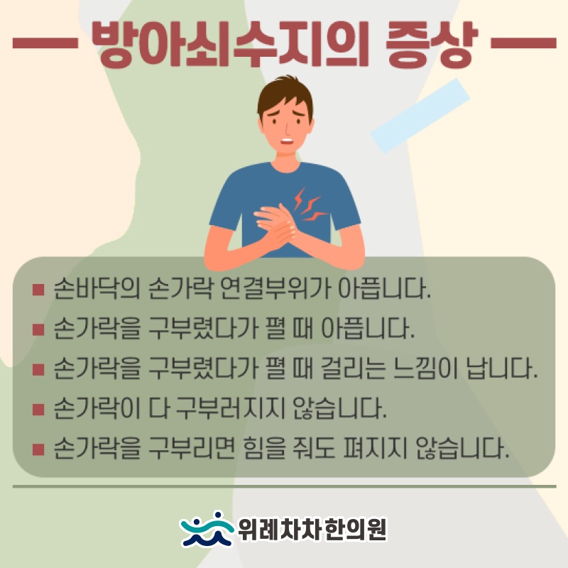 손 질환 중 흔한 방아쇠수지의 발생 특징