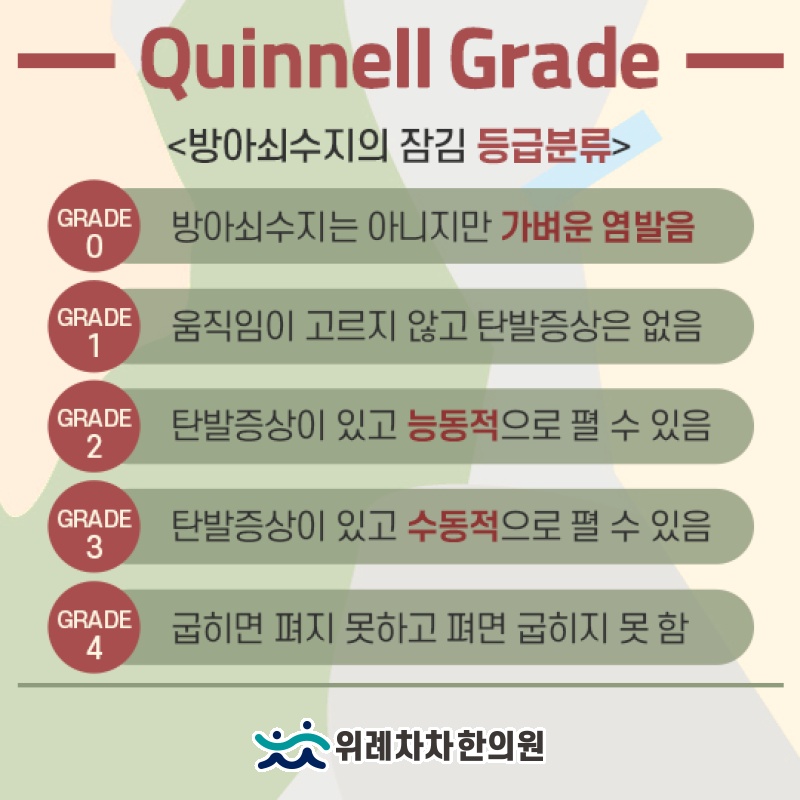 손 질환 중 흔한 방아쇠수지의 발생 특징