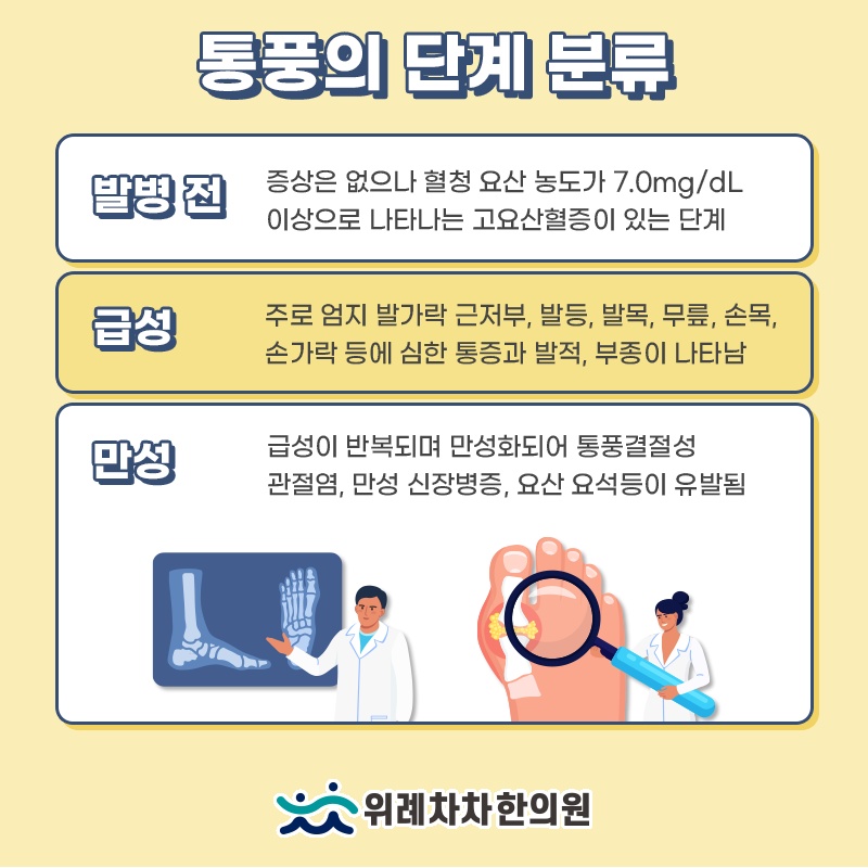 갑작스러운 관절 통증으로 나타나는 통풍의 주요 양상