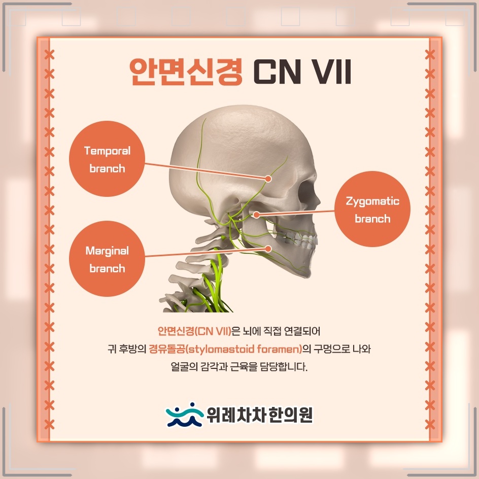 안면신경마비 초기 눈 밑 떨림의 의미와 관찰 포인트