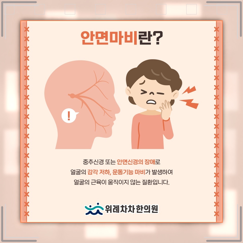 안면신경마비 초기 눈 밑 떨림의 의미와 관찰 포인트