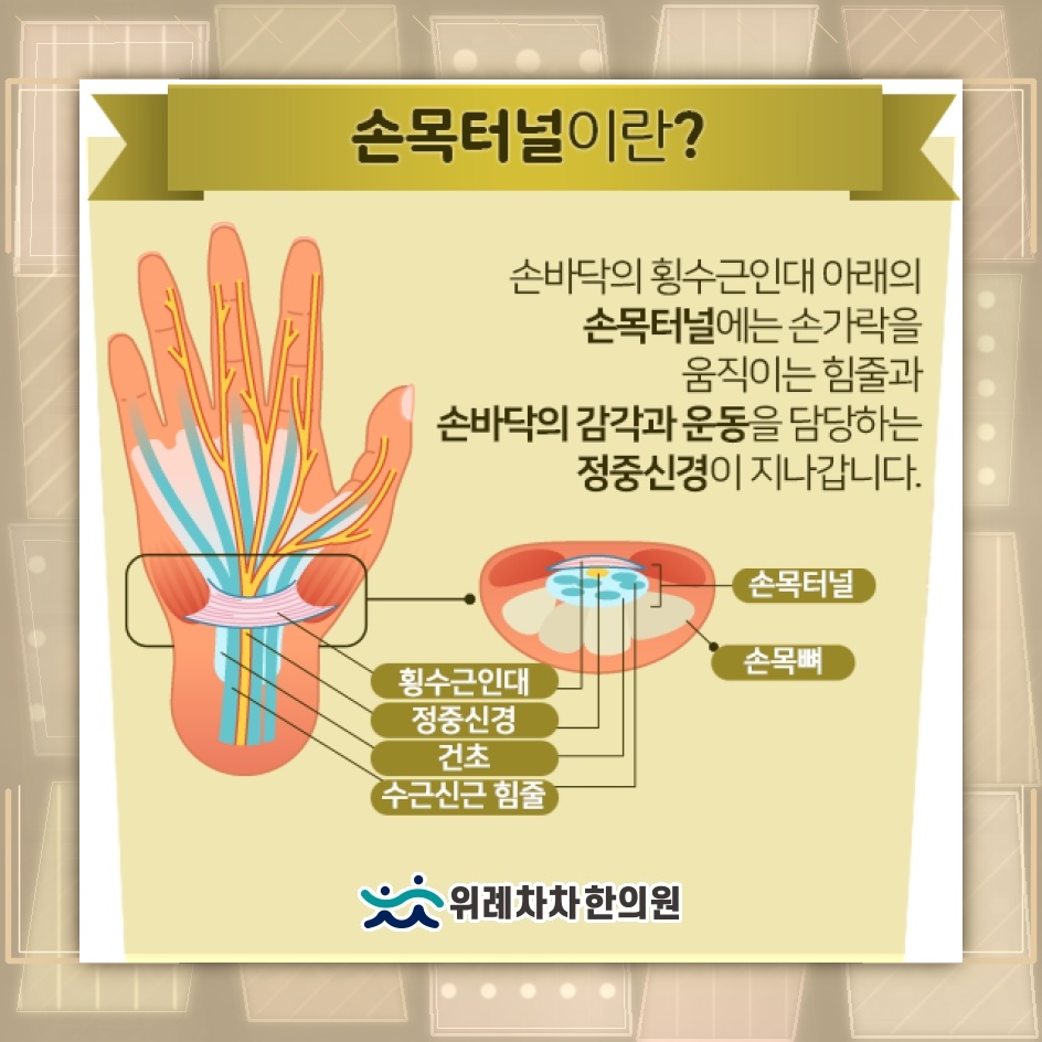 손목터널증후군과 손목을 구부리는 습관 점검