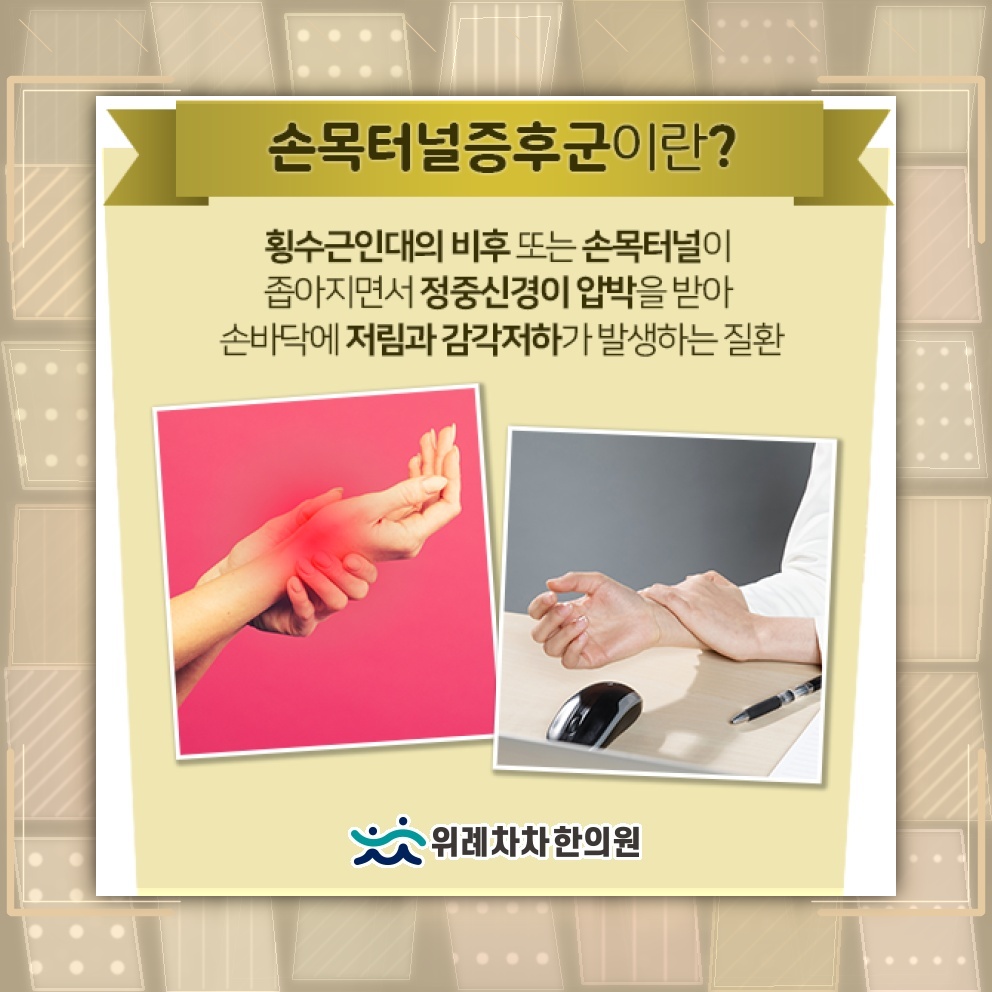 손목터널증후군과 손목을 구부리는 습관 점검